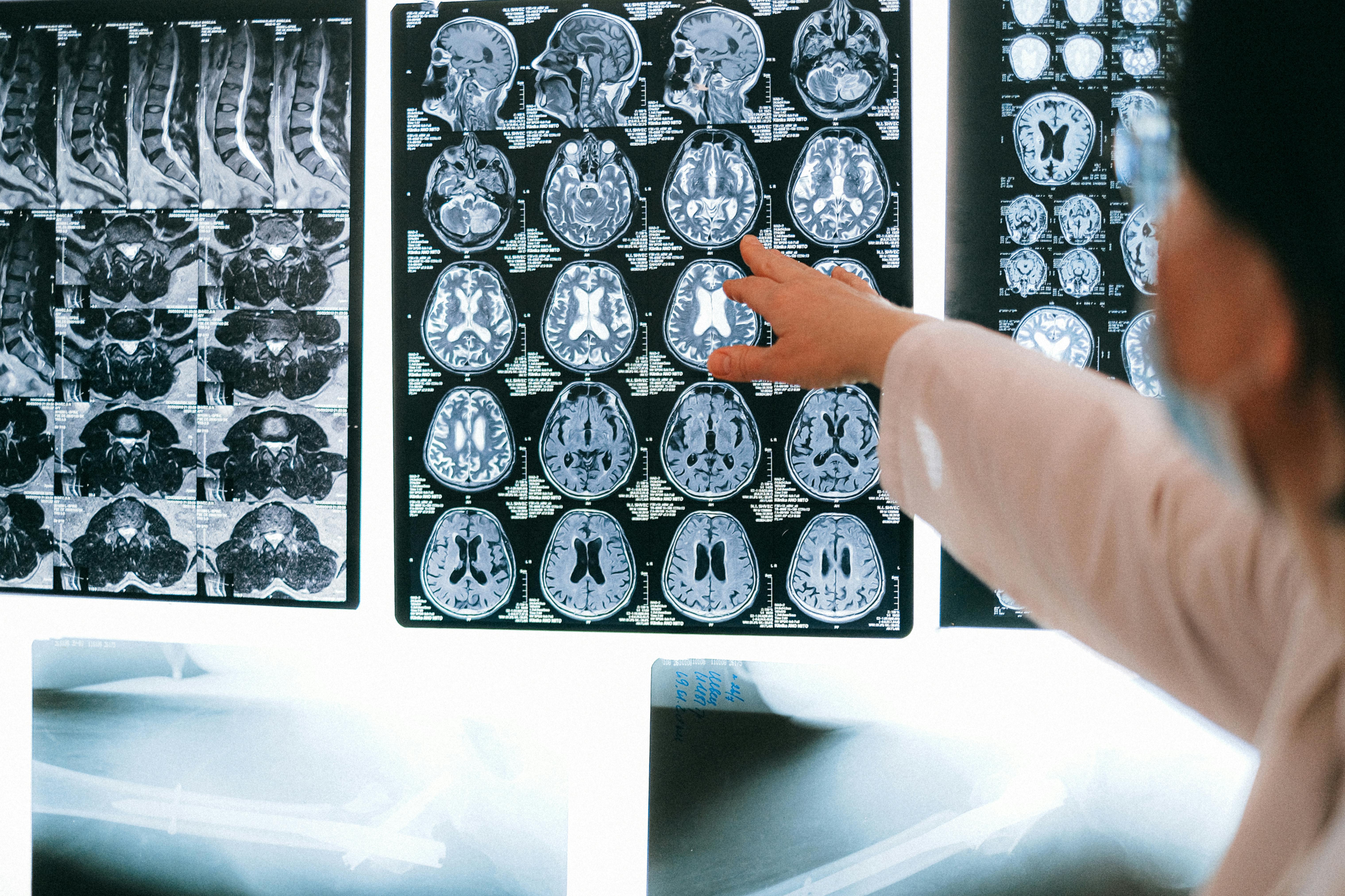 医学影像技术专业主要学什么？未来有哪些就业方向？